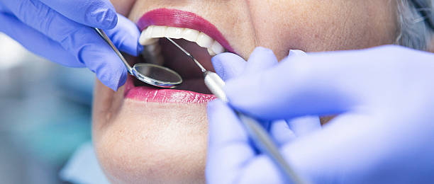 Best Emergency Tooth Extraction in Langley, WA